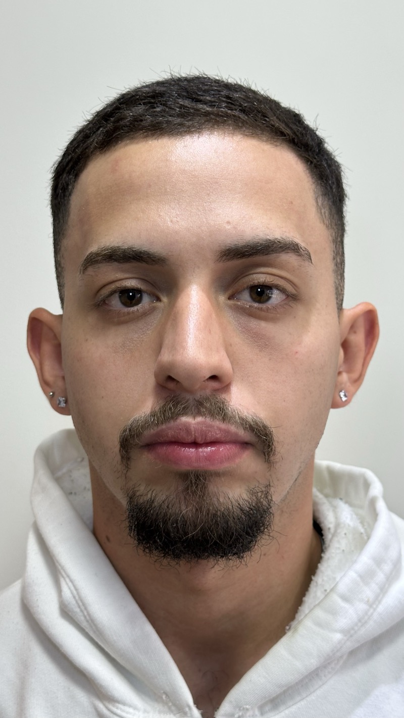 Antes — Preenchimento de Mandíbula