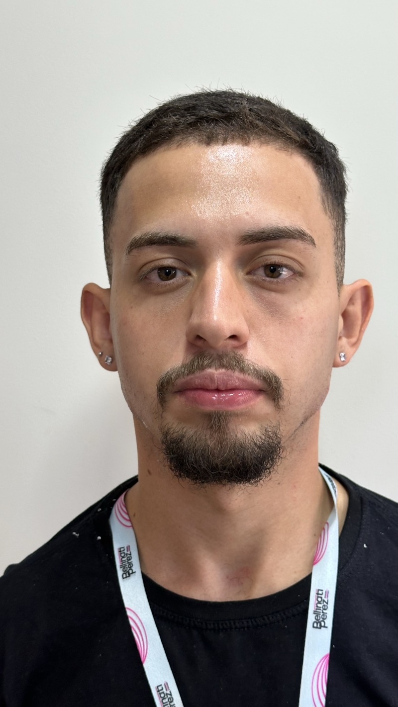 Depois — Preenchimento de Mandíbula